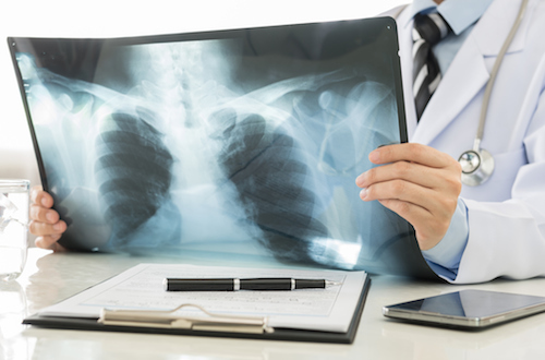 X-ray – Stockfoto